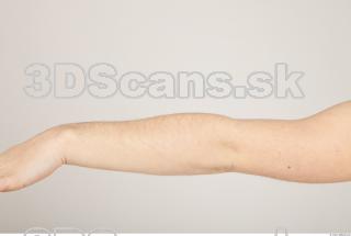 Photo reference of forearm 0001